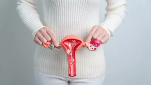 Leiomioma Uterino: Entenda, Previna e Trate