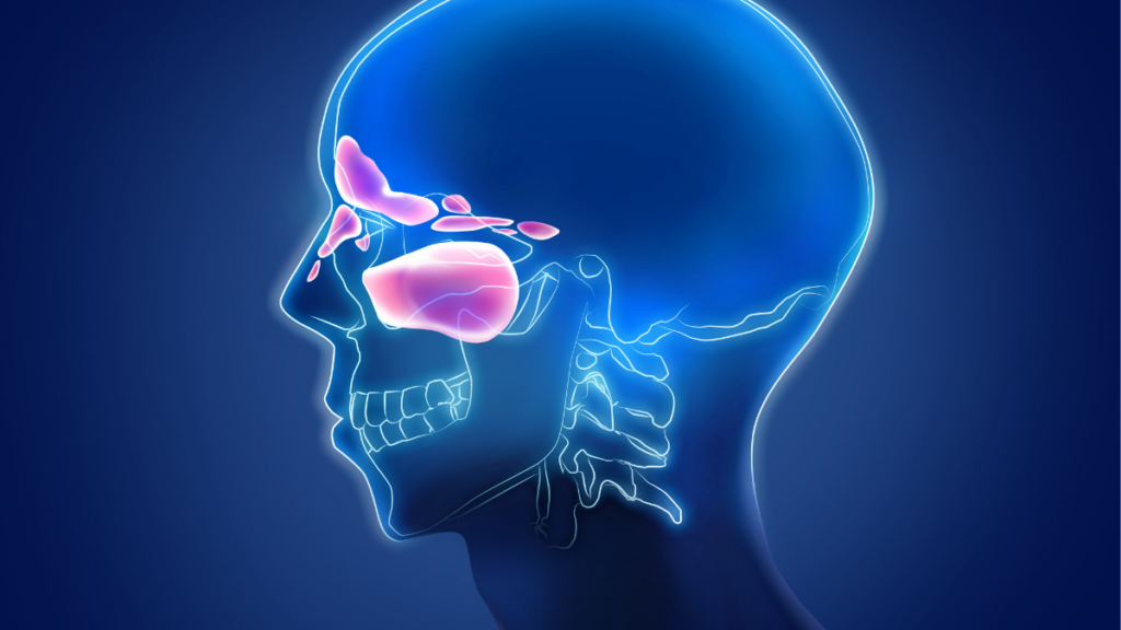 Sinusite: entenda os sintomas, tratamentos e dicas para prevenção