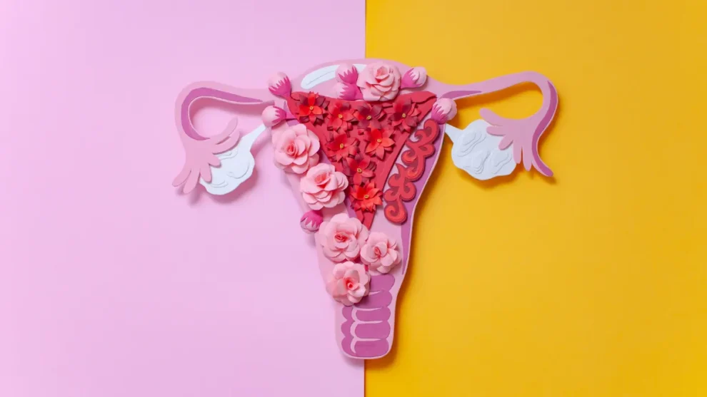Endometriose: Tudo o Que Você Precisa Saber