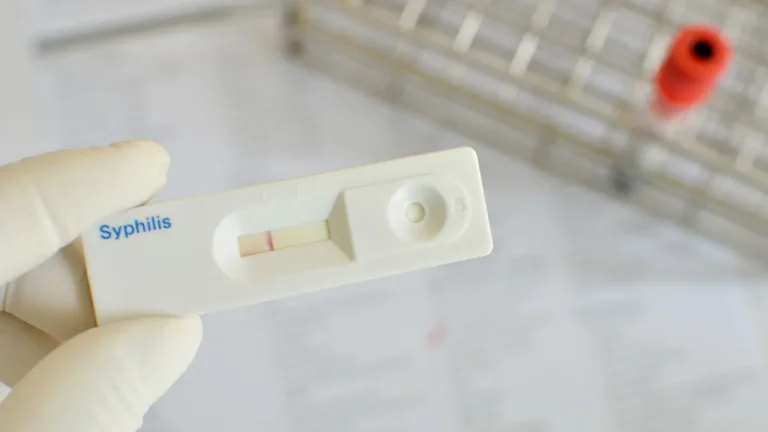 Sífilis: O Que Você Precisa Saber Para Prevenir e Tratar