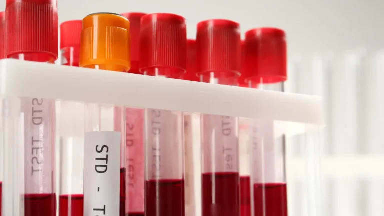 Infecções Sexualmente Transmissíveis (Antigas DSTs): O Que Você Precisa Saber