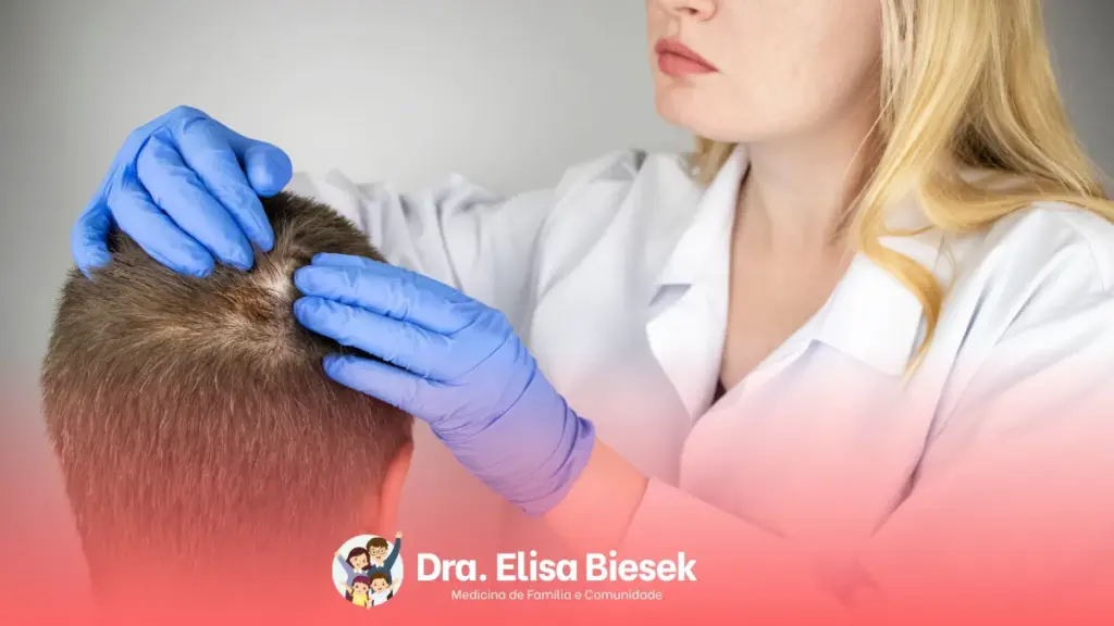 Entendendo a alopecia: uma abordagem completa para cuidar da sua saúde