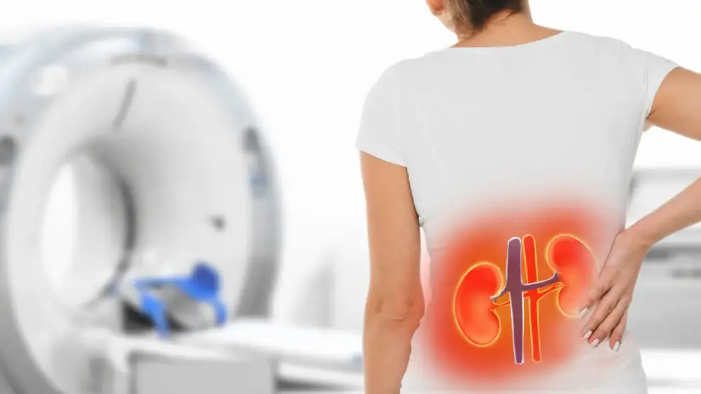 Falência Renal: Entenda os Riscos e Como Prevenir