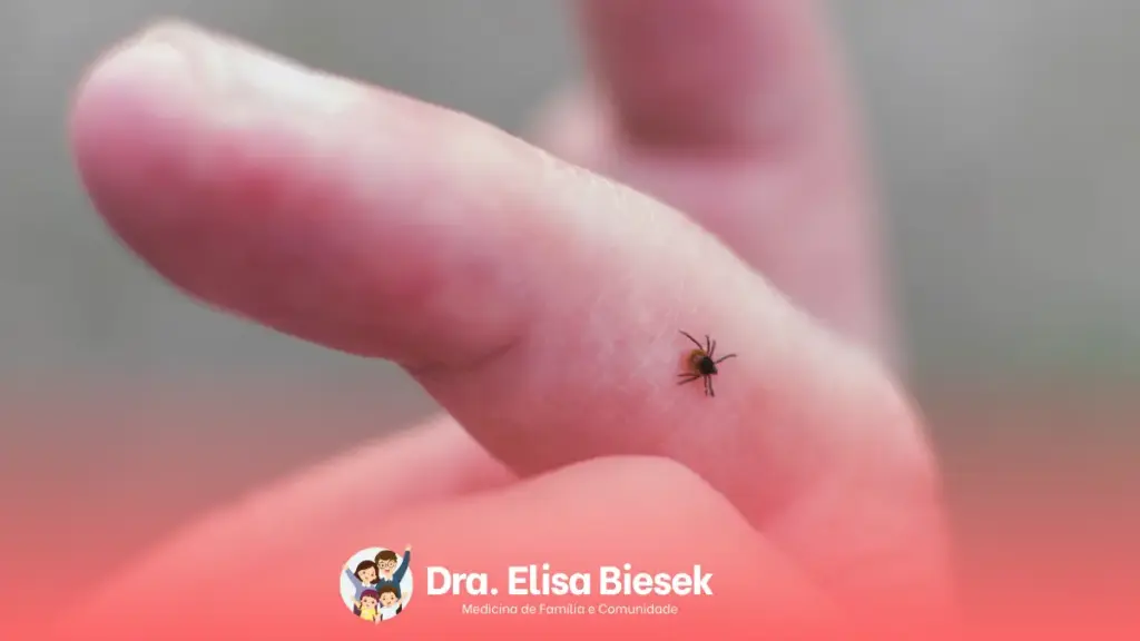 Doença de lyme: conheça essa doença do carrapato Doença de lyme: conheça essa doença do carrapato
