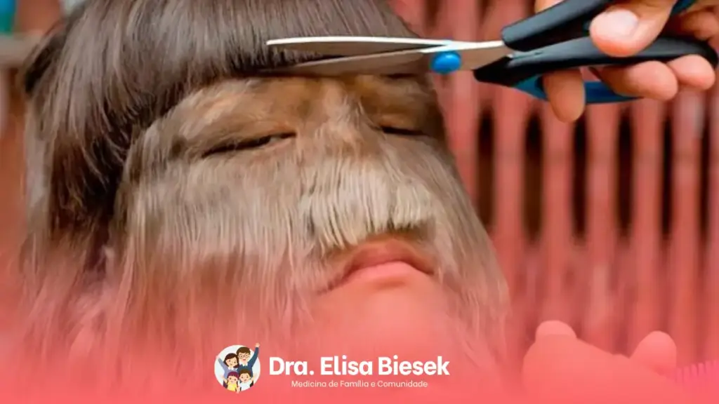Hipertricose: conheça a condição que acelera o crescimento dos pelos do corpo Hipertricose: conheça a condição que acelera o crescimento dos pelos do corpo