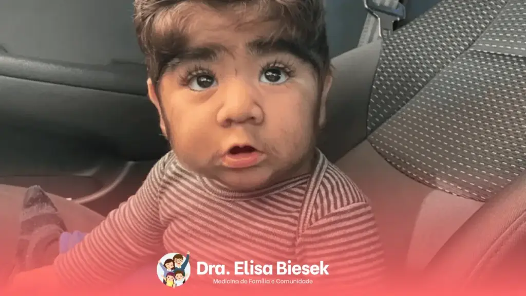 Hipertricose: conheça a condição que acelera o crescimento dos pelos do corpo Hipertricose: conheça a condição que acelera o crescimento dos pelos do corpo